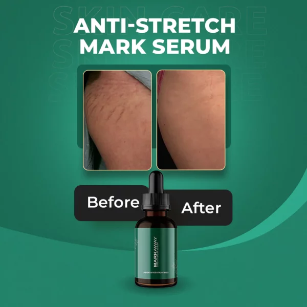 Markaway Stretch Mark Serum - Image 4